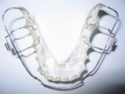 wraparound retainer