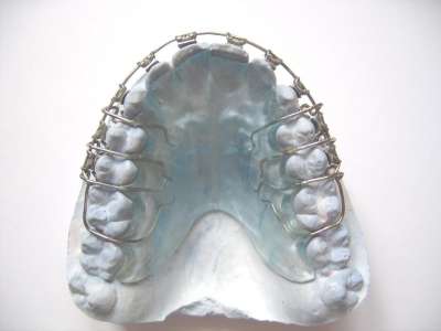 Retainer with Brackets | Fake Braces | BracesShop.com