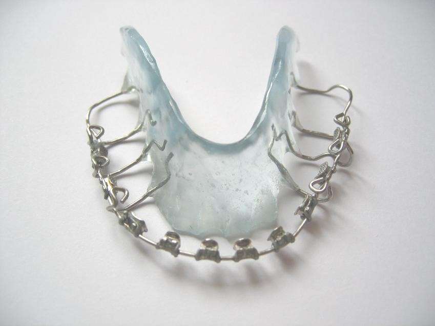 Retainer with Brackets | Clear Retainers and Fake Braces | BracesShop.com